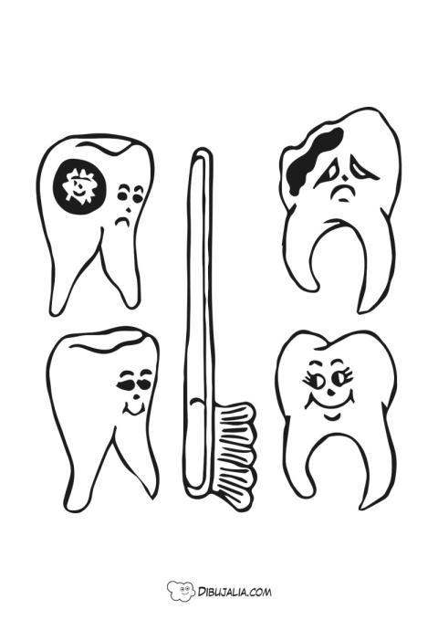 Muelas con caries y sanas